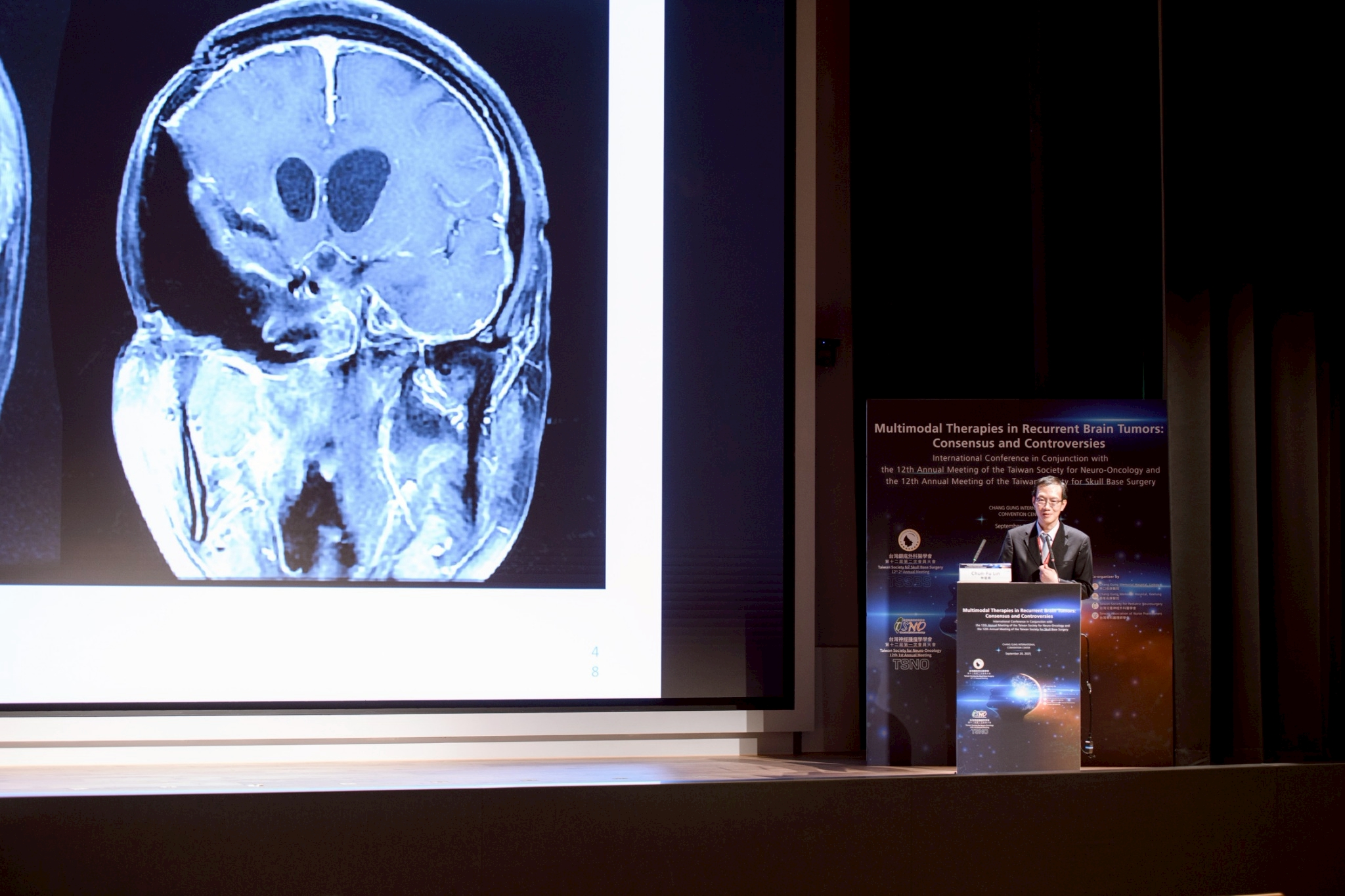 2025.09.20 台灣神經腫瘤學學會第十二屆聯合年會暨國際學術研討會